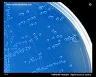 MRSA bacteria